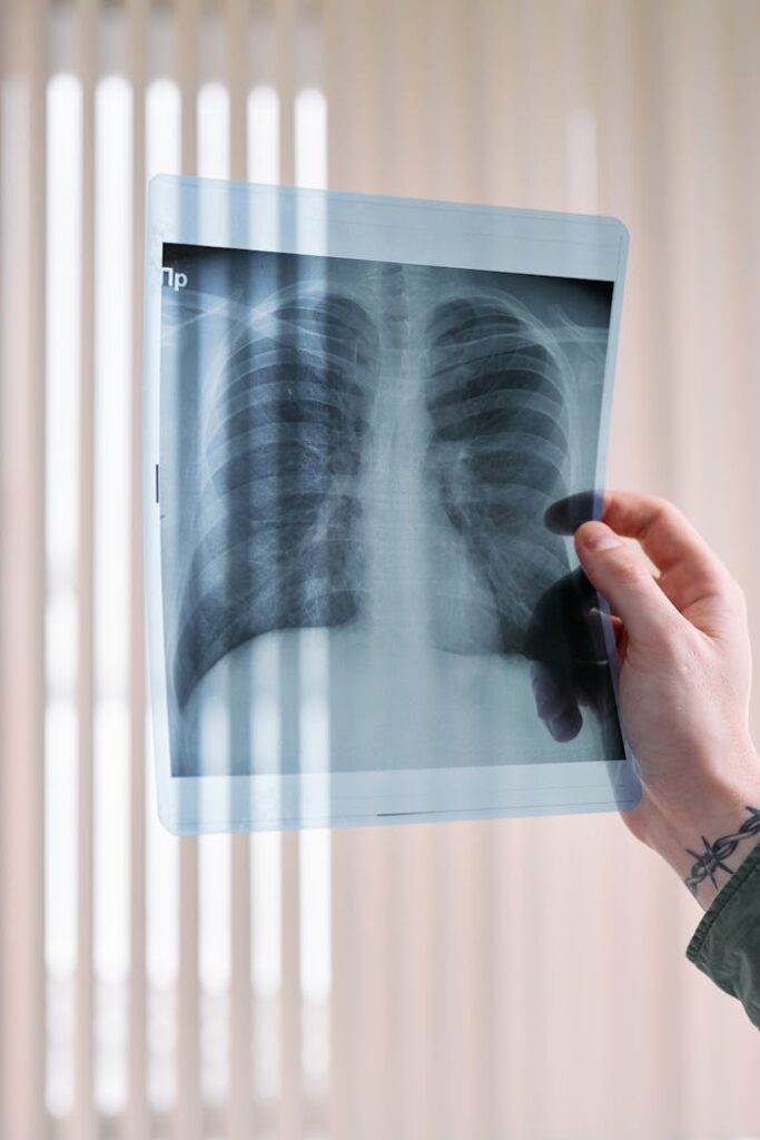 pexels photo 7579829 A vertical shot of a doctor's hand holding a lung x-ray in a medical clinic, focusing on healthcare diagnosis.